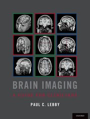 Cover for 

Brain Imaging







