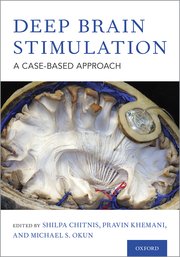 Cover for 

Deep Brain Stimulation






