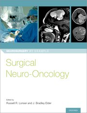 Cover for 

Surgical Neuro-Oncology






