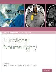 Cover for 

Functional Neurosurgery







