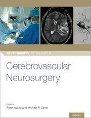 Cover for 

Cerebrovascular Neurosurgery






