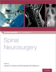 Cover for 

Spinal Neurosurgery






