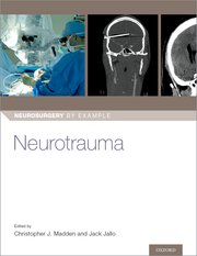 Cover for 

Neurotrauma






