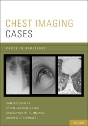 Cover for 

Chest Imaging Cases






