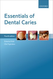 Cover for 

Essentials of Dental Caries






