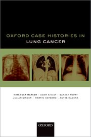 Cover for 

Oxford Case Histories in Lung Cancer






