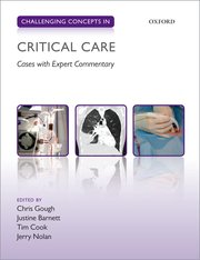 Cover for 

Challenging Concepts in Critical Care






