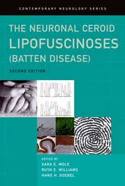 Cover for 

The Neuronal Ceroid Lipofuscinoses (Batten Disease)






