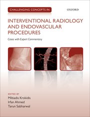 Cover for 

Challenging Concepts in INTERVENTIONAL RADIOLOGY






