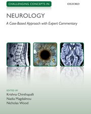 Cover for 

Challenging Concepts in Neurology







