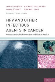 Cover for 

HPV and Other Infectious Agents in Cancer






