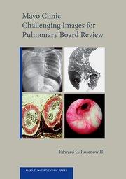 Cover for 

Mayo Clinic Challenging Images for Pulmonary Board Review






