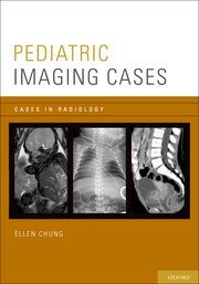 Cover for 

Pediatric Imaging Cases






