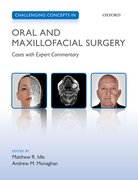Cover for Challenging Concepts in Oral and Maxillofacial Surgery