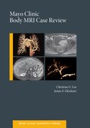Cover for Mayo Clinic Body MRI Case Review